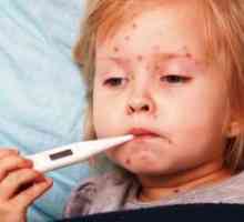 Streptoderma pri otrocih - zdravila za zdravljenje