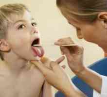 Streptokokni okužbe pri otrocih