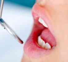 Fistula na dlesni