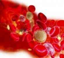 Trombocitopenija - Vzroki in zdravljenje