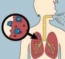 Tuberkuloza - Zdravljenje