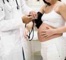 Palpitacije med nosečnostjo