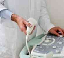Ultrazvok za ugotavljanje nosečnosti