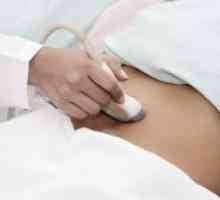Medeničnega ultrazvok pri ženskah - kako se pripraviti?