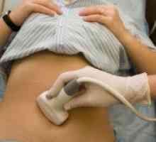 Medenice ultrazvok pri ženskah