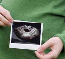 Uzi med nosečnostjo: časovnica