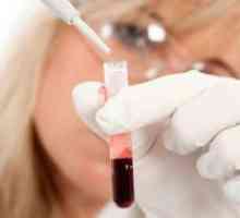 B12 pomanjkljivost anemija