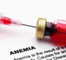 Vrste anemija