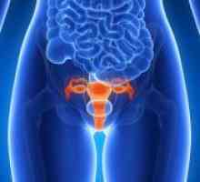 Notranji endometrioza - Zdravljenje