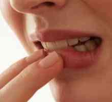 Vnetje dlesni okoli zoba