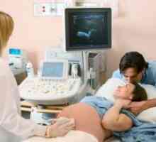 Drugi ultrazvok v nosečnosti