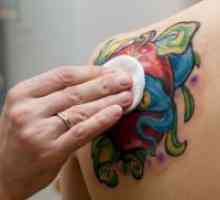 Tattoo zdravljenje