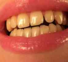 Rumene zobe