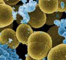 Staphylococcus aureus v materinem mleku