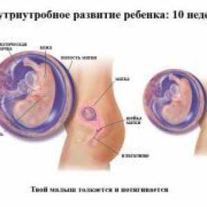 Porodniška 10 tednu nosečnosti