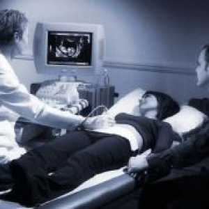 21 Tednov noseča - ultrazvok