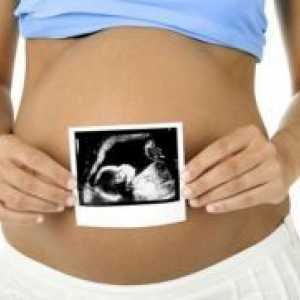 Adenomioza in nosečnost