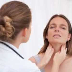Avtoimunski tiroiditis - Simptomi