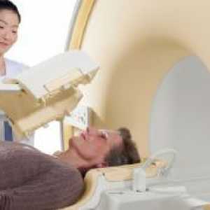 Kaj pomeni MRI možganov?