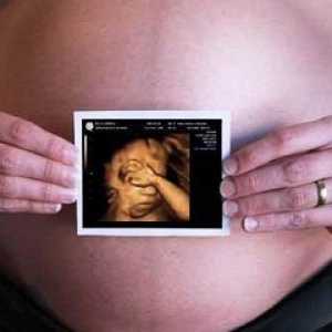 Kaj je 3D ultrazvok v nosečnosti