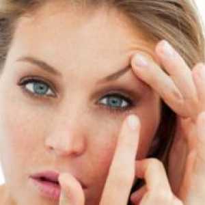 Eye Acne - Simptomi in zdravljenje