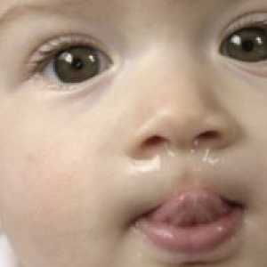 Fiziološki izcedek iz nosu pri dojenčkih