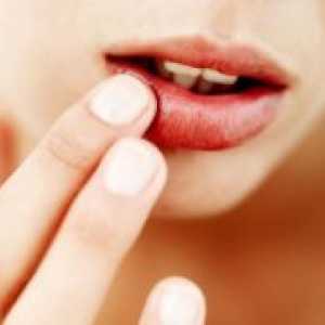 Herpes na ustnicah - vzroki