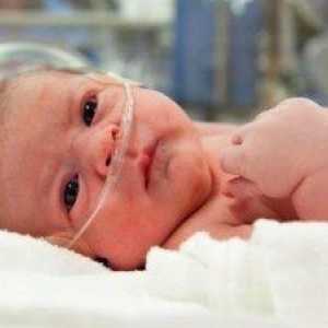 Hipoksija pri novorojenčkih - kaj je to?