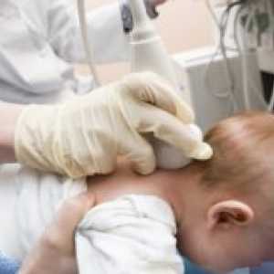 Cerebralne ishemije pri novorojenčkih