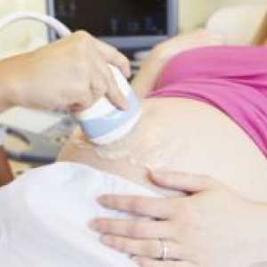 Materničnega vratu nesposobnost med nosečnostjo