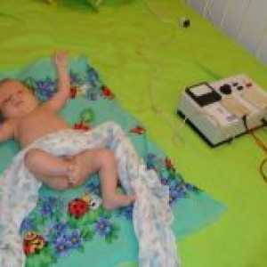 Elektroforeza za dojenčke