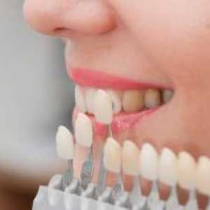 Estetska zobna obnova