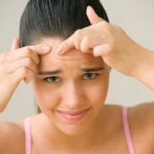 Kako se znebiti akne na obrazu najstnik?