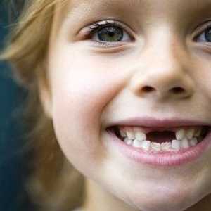 Kako spremeniti zob pri otrocih