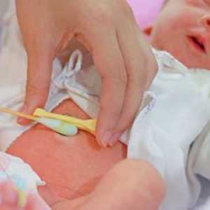 Kako ravnati popka novorojenčka
