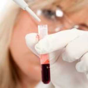 Kako ugotoviti otrokovo krvno skupino krvno skupino staršev?
