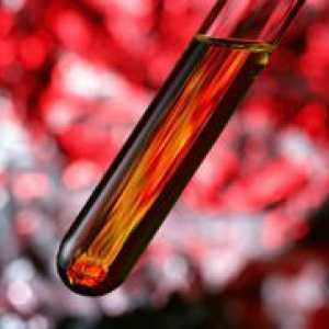 Kako znižati hemoglobina v krvi?
