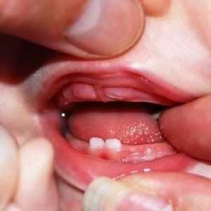 Kako rastejo zob pri otrocih?