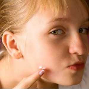Kako odstraniti akne na obrazu