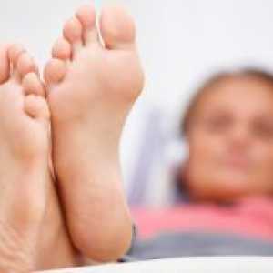 Kako za zdravljenje glivic na nogah?