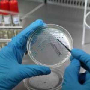 E. coli v brisa