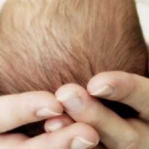 Možganske ciste pri novorojenčkih