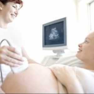Kdaj ultrazvok v nosečnosti?