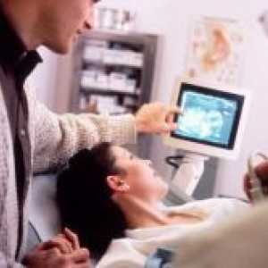 Ko je videl na ultrazvok nosečnosti?