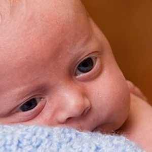Konjunktivitis pri novorojenčkih