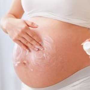 Krema za strij med nosečnostjo