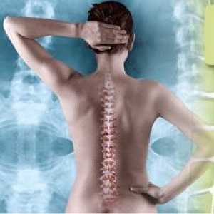 Zdravljenje izboklino ledvene hrbtenice