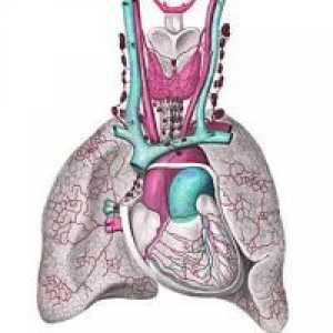 Pljučna hipertenzija - Zdravljenje