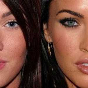 Megan Fox pred in po plastike