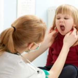 Mononukleoza pri otrocih - Zdravljenje
